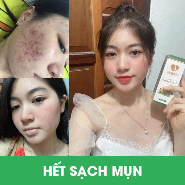 Serum Tái Tạo Da Yody White Phương Anh – Tái Tạo Da Hiệu Quả