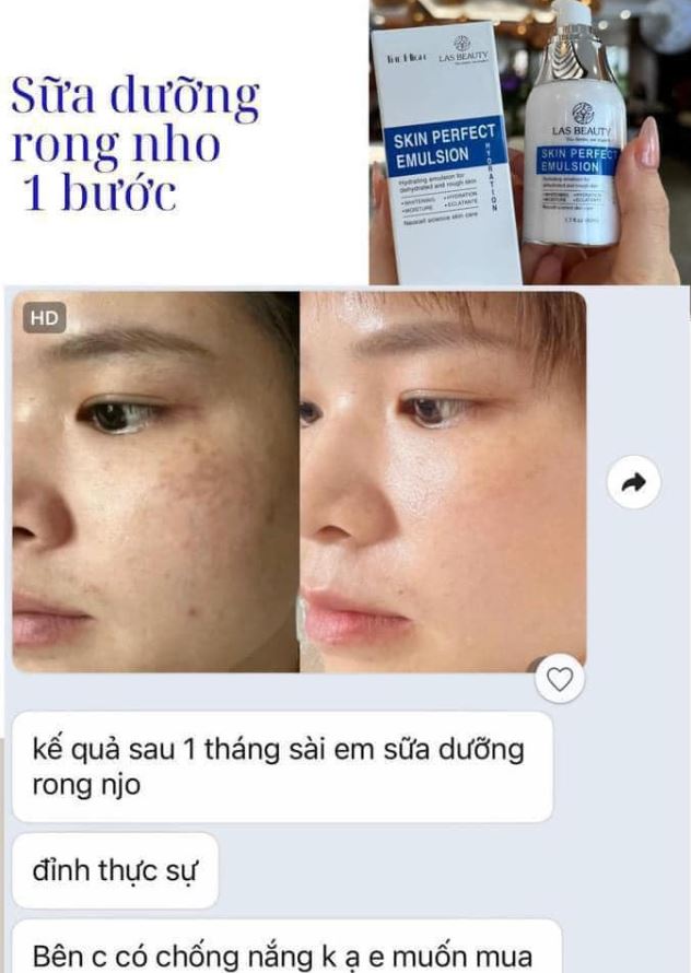 Sữa Dưỡng Rong Nho Las Beauty – Tái Sinh Phục Hồi Da – Hàng Chính Hãng