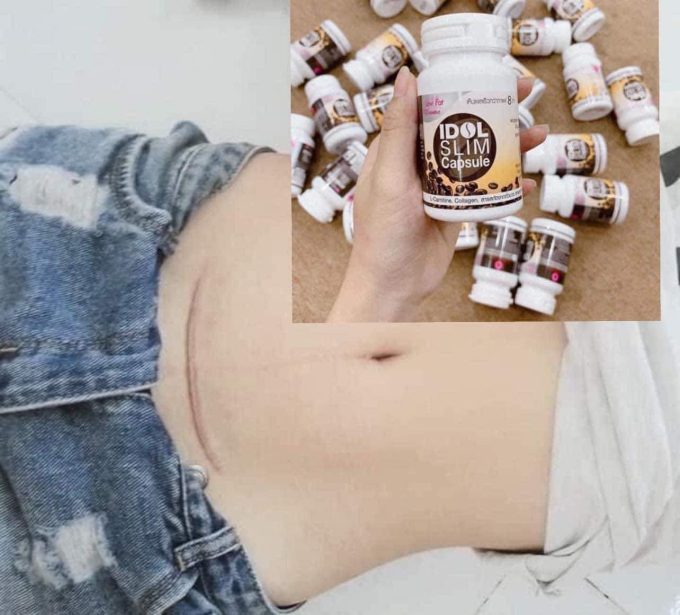 Giảm Cân Idol Slim Capsule 15 Viên | Giảm Nhanh 3-7 Sau 1 Liệu Trình